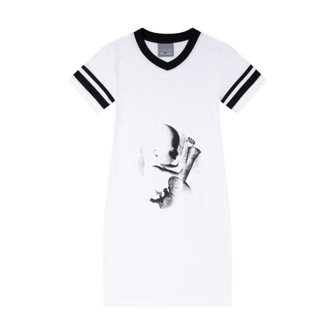 BABY VARSITY T DRESS